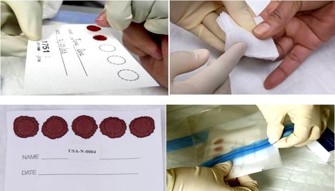 Slika 7. Prikupljanje uzoraka krvi u dojilja i dojenčadi pomoću DBS kartica (engl. dried blood spot, DBS).