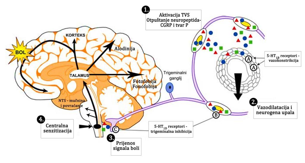 Slika 2. Patofiziologija migrenske glavobolje: aktivacija i senzitizacija trigeminovaskularnog sustava (1-4). Zahvatna mjesta djelovanja triptana (A-C).