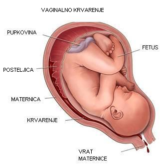 Krv si pravi put između plodovih ovoja i stijenke uterusa te istječe kroz cervikalni kanal i