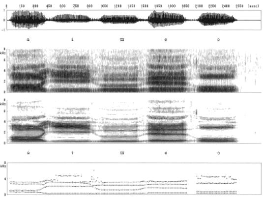 oslabljeni rezonantnom modulacijom delova vokalnog trakta iznad i ispod glasnica, ljudski glas postaje kompleksan, individualan, složen zvuk koji ima lepotu i modulaciju (Sataloff, 2005:81).