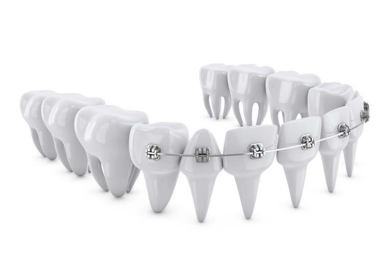 Ortodoncija Ortodoncija se bavi rješavanjem problema položaja zubi korištenjem kontinuiranih slabih sila što omogućava pomak zubi bez kolateralnih učinaka.
