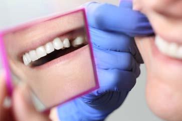 Nakon vađenja Nakon svakog vađenja treba zaustaviti krvarenje pomoću sterilne gaze koja se mora držati čvrsto stisnutom između zuba na rani oko 15 minuta.