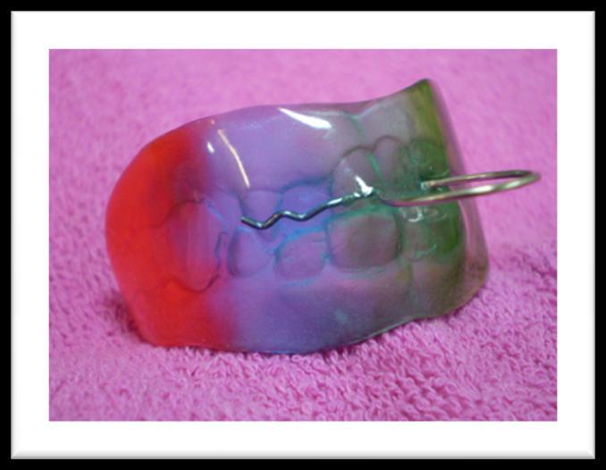 Kod klase II/1 vestibularna ploča prilijeţe uz gornje frontalne zube i s oralne strane moţe imati akrilatnu nagriznu vodilju koja omogućava drţanje mandibule u mezijalnom poloţaju.