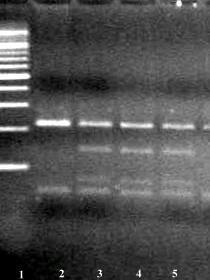 Slika 15 - PCR RFLP detekcija Val66Met polimorfizma BDNF gena, digestijom sa NlaIII