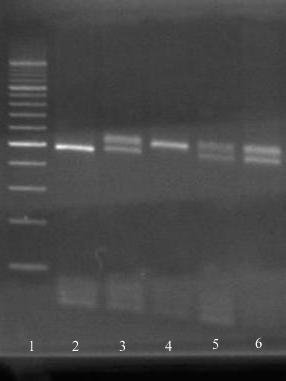 Slika 17 - PCR analiza polimorfizma HTTLPR l/s 1.