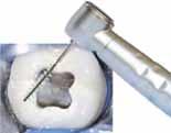 Šprice Luer Lock Za višestruku uporabu Graduirane skalom cc (ml). Nahrapavljena hvatišta onemogućuju sklizanje. 1,2 ml 3 ml 5/6 ml 12 ml Nesterilne, mogu se autoklavirati Prihvat Luer Lock standard.