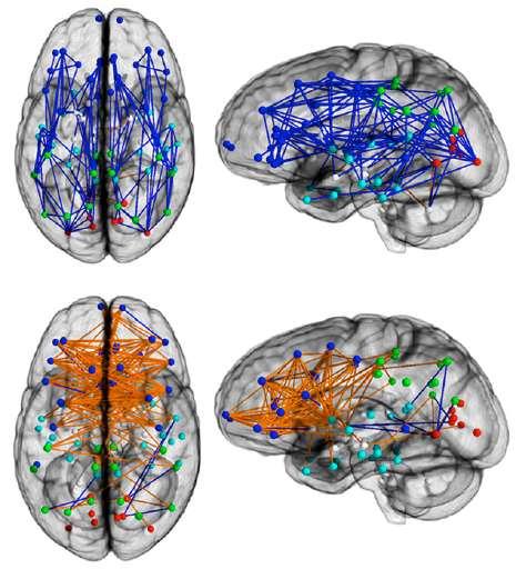 Razlike u strukturi i funkciji mozga žena i muškaraca biološki, psihološki i socijalni aspekti Mladenka