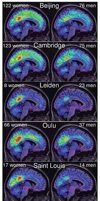 Razlike u gustoći funkcionalne povezanosti MR podaci na 336 žena i 225 muškaraca su uputili na spolni dimorfizam u funkcionalnoj organizaciji mozga žene imaju 14% više izraženu lokalnu funkcionalnu