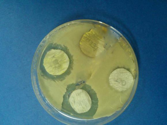 sredstvom (Slika 6.). Slika 6. Mjerenje promjera kruga bez bakterija Relativno najveći koeficijent pokazuje otopina sumameda, dok najmanji pokazuje octanisept.