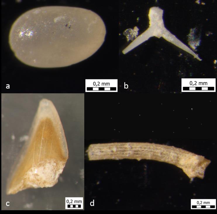 3.2.5 OSTALO Mikroskopiranjem obrađenih uzoraka nađeni su brojni ostrakodi, spikule spužvi, radiole ježinaca i zubi riba (Tablica 3, Slika 18), a nađen je i jedan sklerit trpa. Tablica 3.