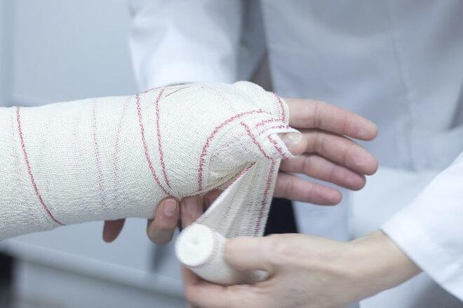 Uzroci lomova kostiju ruke Izravan udarac u ruku ili zapešće, može dovesti do loma bilo koje kosti u njima.