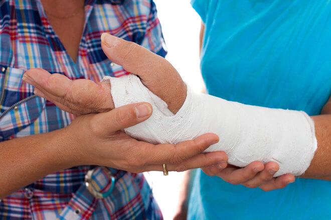 Prijelom ruke komplikacije Trajanje liječenja ovisi o težini prijeloma te o tome radi li se o klasičnom ili vanjskom prijelomu ruke. U svakom slučaju liječenje prijeloma je dugotrajan proces.