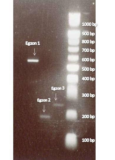 Slika 4.1. Prikaz produkata PCR amplifikacije egzona gena VHL nakon elektroforeze na 2% agaroznom gelu.