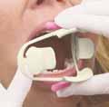 Sinergijska formula obogaćena Kalcijem,Kalij-nitratom i Fluorom: Jačanje dentina i zaštita od karijesa Prevencija preosjetljivosti NTURL+ je nježniji i sigurniji