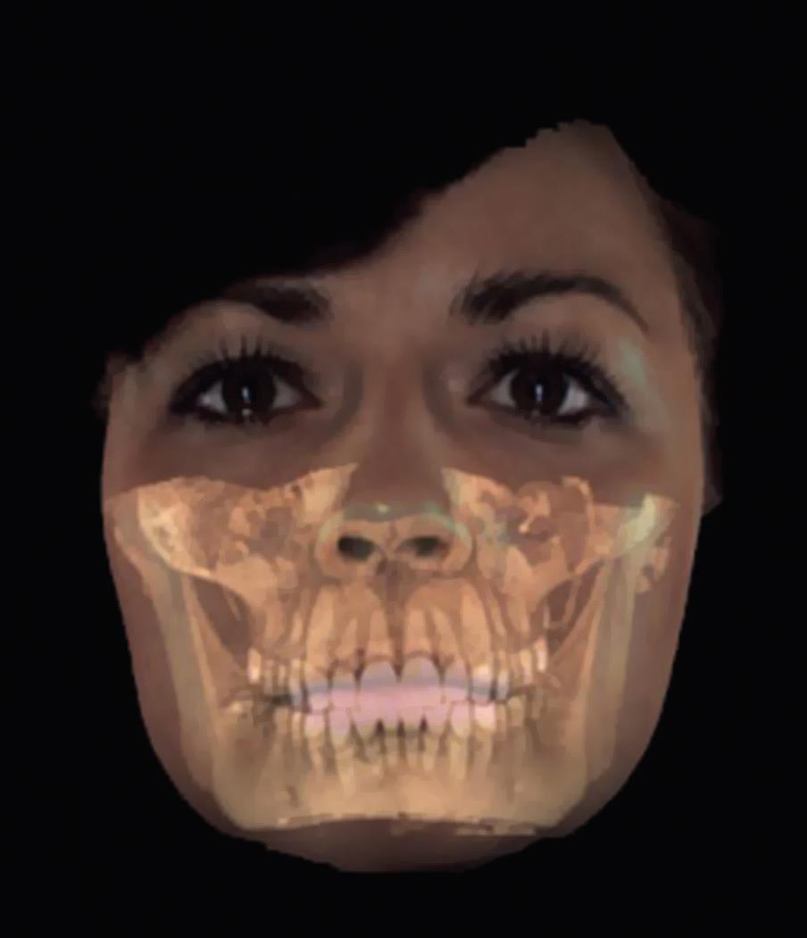 1.3. Dokumentacija lica i glave Dvodimenzionalne slike se desetljećima koriste u ortodonciji za dijagnostiku i analizu.
