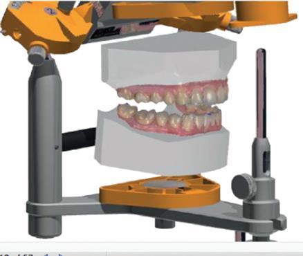 svega, zubne krune se trebaju segmentirati koristeći određeni softver (npr. Planmeca 3d OrthoStudio, Planmeca OY, Helsinki, Finland).