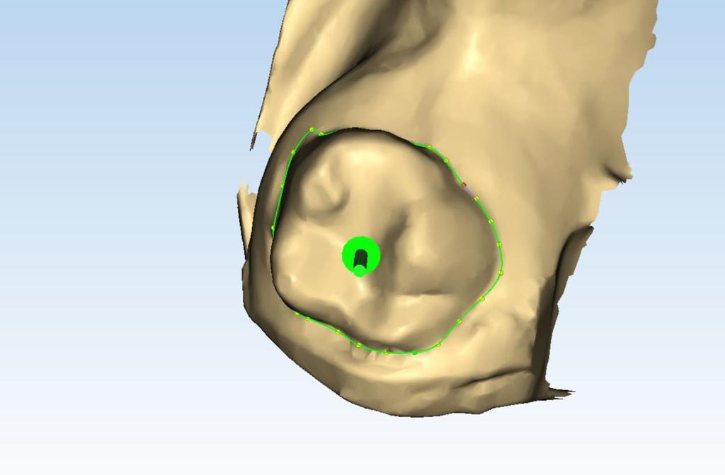 Slika 14. Segmentiranje modela Planmeca 3dOrthoStudio.
