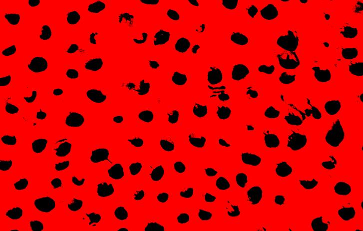 Слика 6.13. Шематски приказ микрографије (увеличање 2000x) за бројање отворених (црна) и затворених дентинских тубула (црвена) 4.