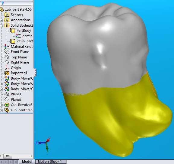 Nakon što je izrađen 3D model zuba slijedi pridruživanje svojstva materijala koja odgovaraju
