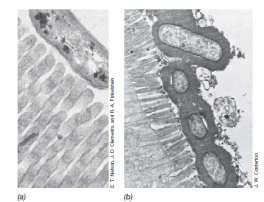 Površinske strukture koje potpomažu pričvršćivanje patogena: - glikokaliks