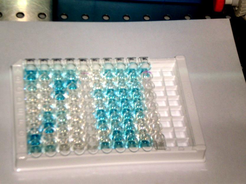 3. Ispitanici i metode Slika 5.Mikrotitarska ploča Sunrise, proizvođača Tecan (fotografirao: S. Burian) 3.5. Genotipizacija HPV-a Linear Array HPV genotyping test je kvalitativni in vitro test koji služi za detekciju HPV-a u kliničkim uzorcima.