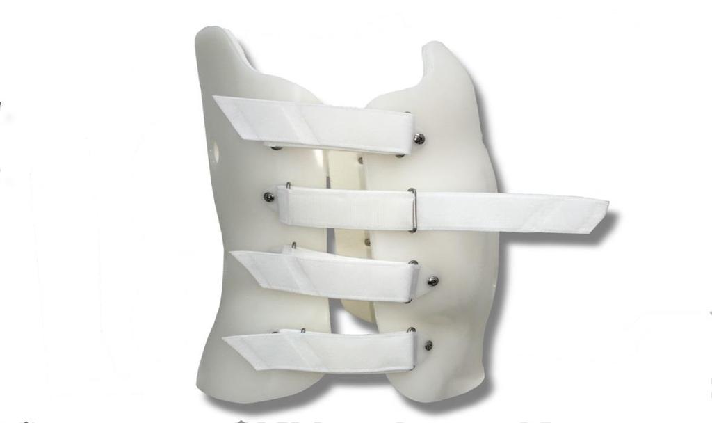Slika 15. Torakolumbalna ortoza za korekciju skolioze (posljedica tuberkuloznog procesa). Preuzeto s: http://www.cascadeorthotics.