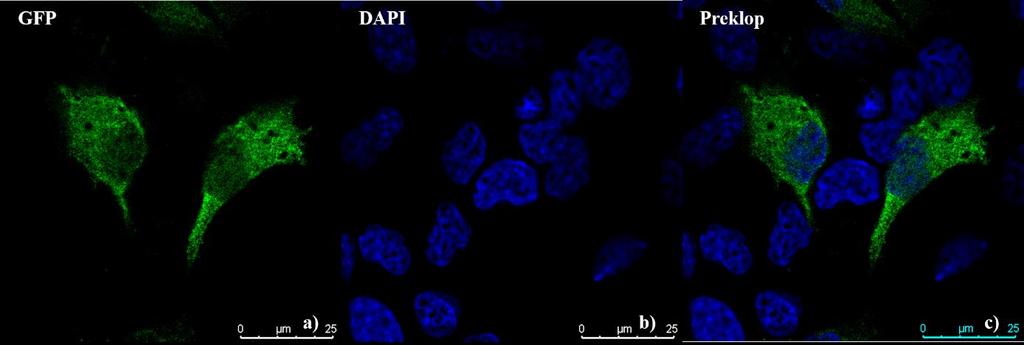 Slika 5. Lokalizacija zelenog fluorescentnog proteina (GFP). Stanice HeLa transfecirane su s pcmv6-gfp i bojane bojom DAPI.