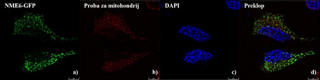 Slika 8. Lokalizacija proteina NME6-GFP. Stanice HeLa transfecirane s pcmv6-nme6-gfp, bojane bojom DAPI i selektivnom probom za mitohondrij (c = 150 nm).