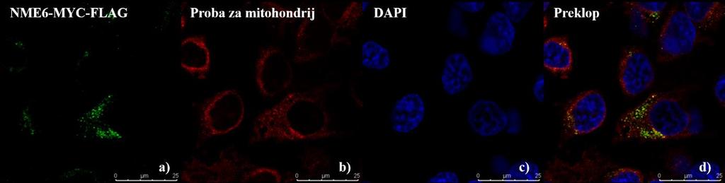 selektivnom probom za mitohondrij (c = 150 nm) a) Lokalizacija NME6-MYC-FLAG ne može se precizno utvrditi. b) Selektivna proba za mitohondrij. c) Jezgre stanica HeLa obojane bojom DAPI.