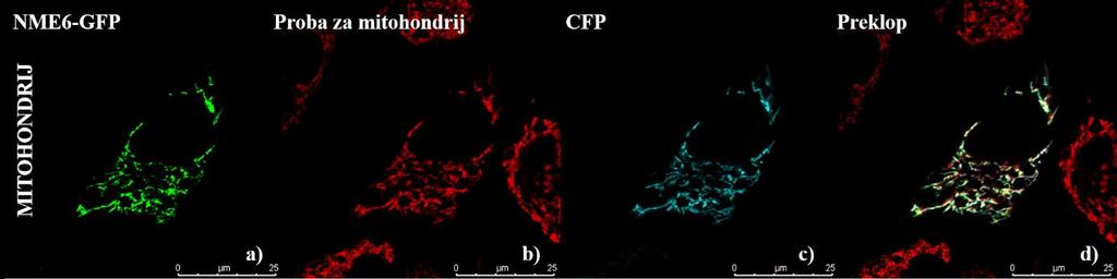 Slika 11. Kolokalizacija proteina NME6-GFP i CFP s mitohondrijima.