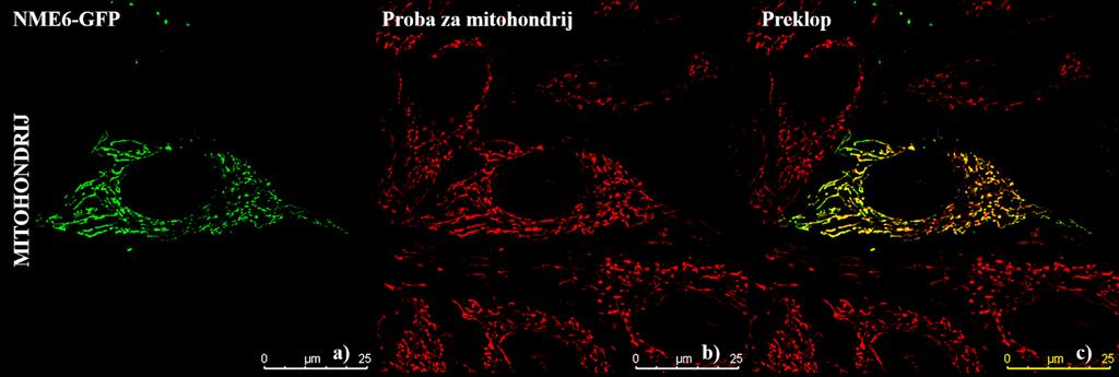 b) Selektivna proba za mitohondrije (c = 150 nm). c) Lokalizacija modrozelenog fluorescentnog proteina (CFP). d) Kolokalizacija proteina NME6-GFP, CFP i selektivne probe za mitohondrij. Slika 12.