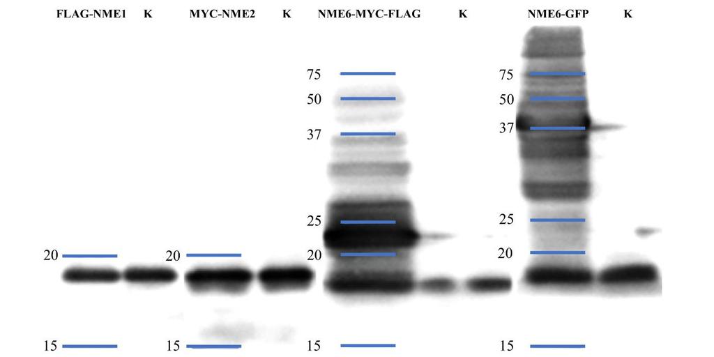 Antitijelo anti-nme6 također je specifično vezalo protein NME6 i potvrdilo njegov izražaj u stanicama HeLa (Slika 16.).