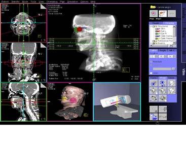 radiodijagnostičara/ familijarnost sa CT anatomijom