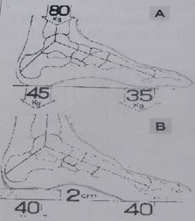 Slika 18. Tačke oslonca stopala spojene uzdužnim i poprečnim svodovima. (Izvor: https://sportspodiatryinfo.wordpress.