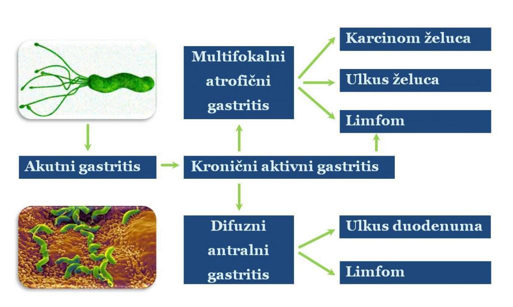 metronidazol ili tertraciklin.