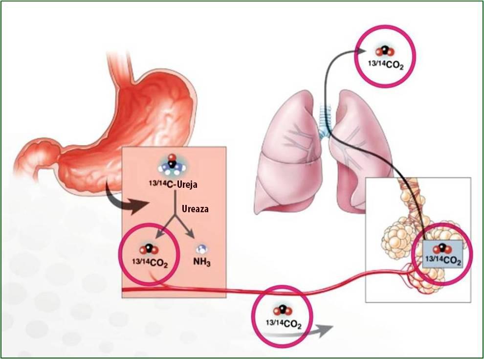 Slika 8: Princip urea izdisajnog testa (preuzeto i prilagođeno s www.reflux.