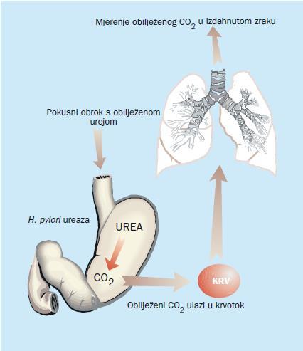 Slika 9: Princip 13C urea izdisajnog testa (preuzeto s Katičić i sur., 2002.