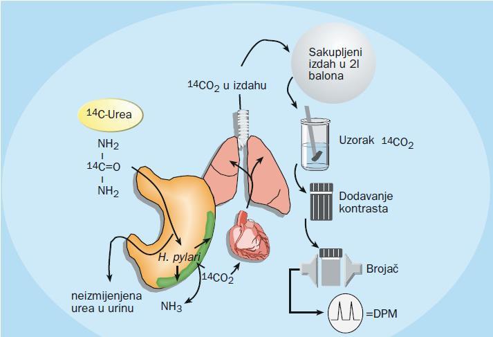 Slika 10: Princip 14C urea izdisajnog testa (preuzeto s Katičić i sur., 2002.) Metoda izvođenja urea izdisajnog testa je jednostavna bez obzira na to koji se izotop rabi.