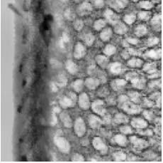 STIM Scanning Transmission Ion Microscopy proton Uzorak STIM Sekcija tkiva (nekoliko µm) izolirane stanice 120 Princip STIM metode - čestica prolaskom kroz uzorak gubi energiju u sudaru