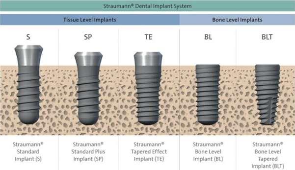 radova bolje je koristiti bone level implantate i pripadajuće suprastrukture.