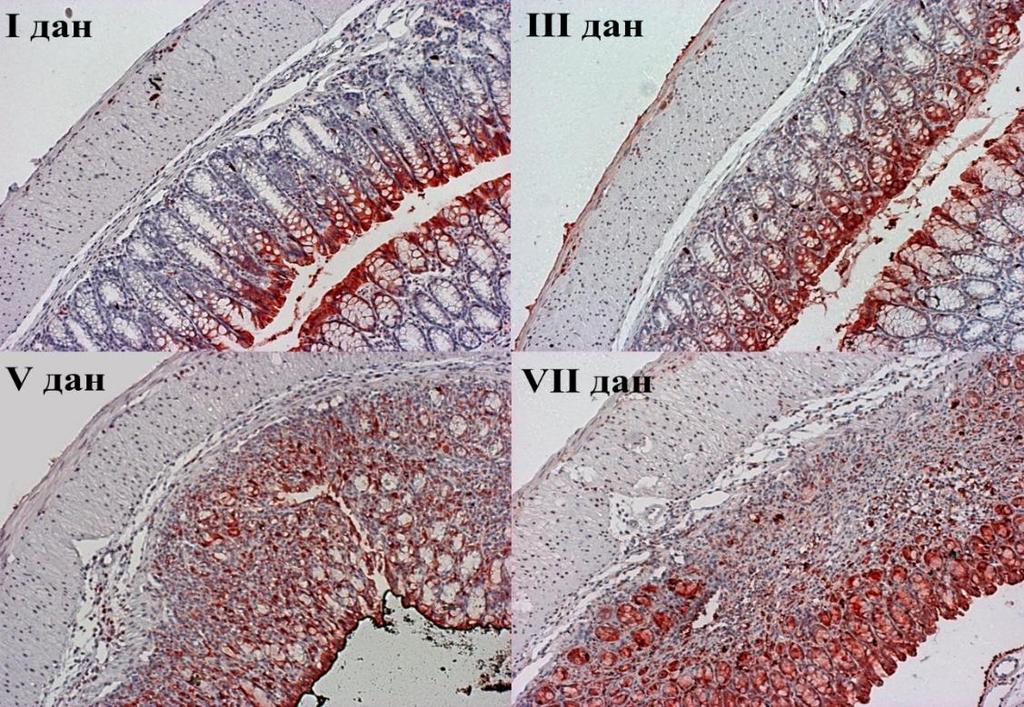 РЕЗУЛТАТИ болести, расте и експресија Gal-3 у ткиву колона (Слика 9).
