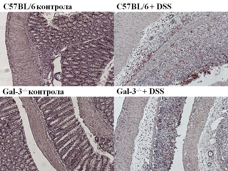 РЕЗУЛТАТИ Слика 11б. Експресија IL-1β у ткиву колона C57BL/6 и Gal-3 -/- мишева (десна страна слике) третираних DSS-ом. У ткиву колона, експресија гена за NLRP3 и IL-1-β је одређена методом PCR.