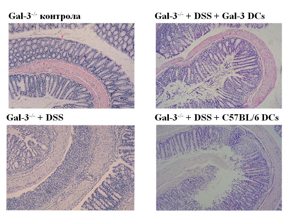 РЕЗУЛТАТИ Слика 13. Репрезентативни патохистолошки препарати Gal-3 -/- мишева третираних DSS-ом након трансфера C57BL/6 и Gal-3 -/- дендритских ћелија (десна страна слике). H/E 100x 4.