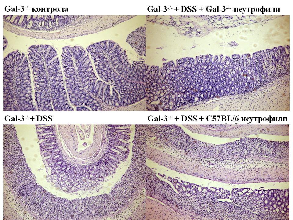 РЕЗУЛТАТИ Сликa 15. Репрезентативни патохистолошки препарати Gal-3 -/- мишева након пасивног трансфера C57BL/6 