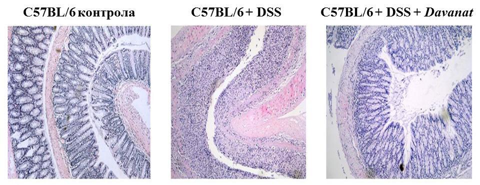 РЕЗУЛТАТИ Слика 19. Репрезентативни препарати колона C57BL/6 мишева након примене Davanat. Стандарно патохистолошко бојење (H&E; увећање x100).