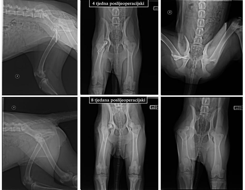 Slika 14. Poslijeoperacijske kontrolne rendgenske snimke Salter-Harris tip I prijeloma glave desne bedrene kosti s 3 ulomka u psa. 4.