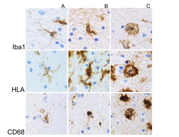Slika 4. Izražaj biljega HLA-DR, Iba1 i CD68 kod različitih fenotipova mikroglija stanica; A) razgranate B) ameboidne stanice i C) pjenasti makrofazi preuzeto iz: Hendrickx i sur., 2017.
