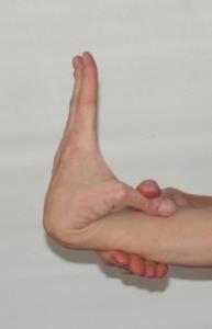 b) Hipermobilnost palca na ruci Pozitivna hipermobilnost palca je prisutna ako ispitanik može palcem dotaknuti donji