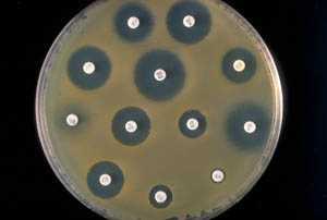 5.2.Kako nastaju superbakterije? R-plazmidi su jedna od najvažnijih i najproučavanijih grupa bakterijskih plazmida.