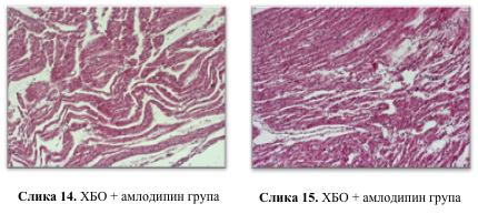 Грађа миокарда у ХБО + амлодипин групи пацова приказана је на сликама 14 и 15.